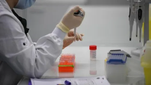 Covid-19, la hausse se confirme